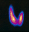 sistema endocrino