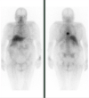 sistema Hematopoyético y linfático